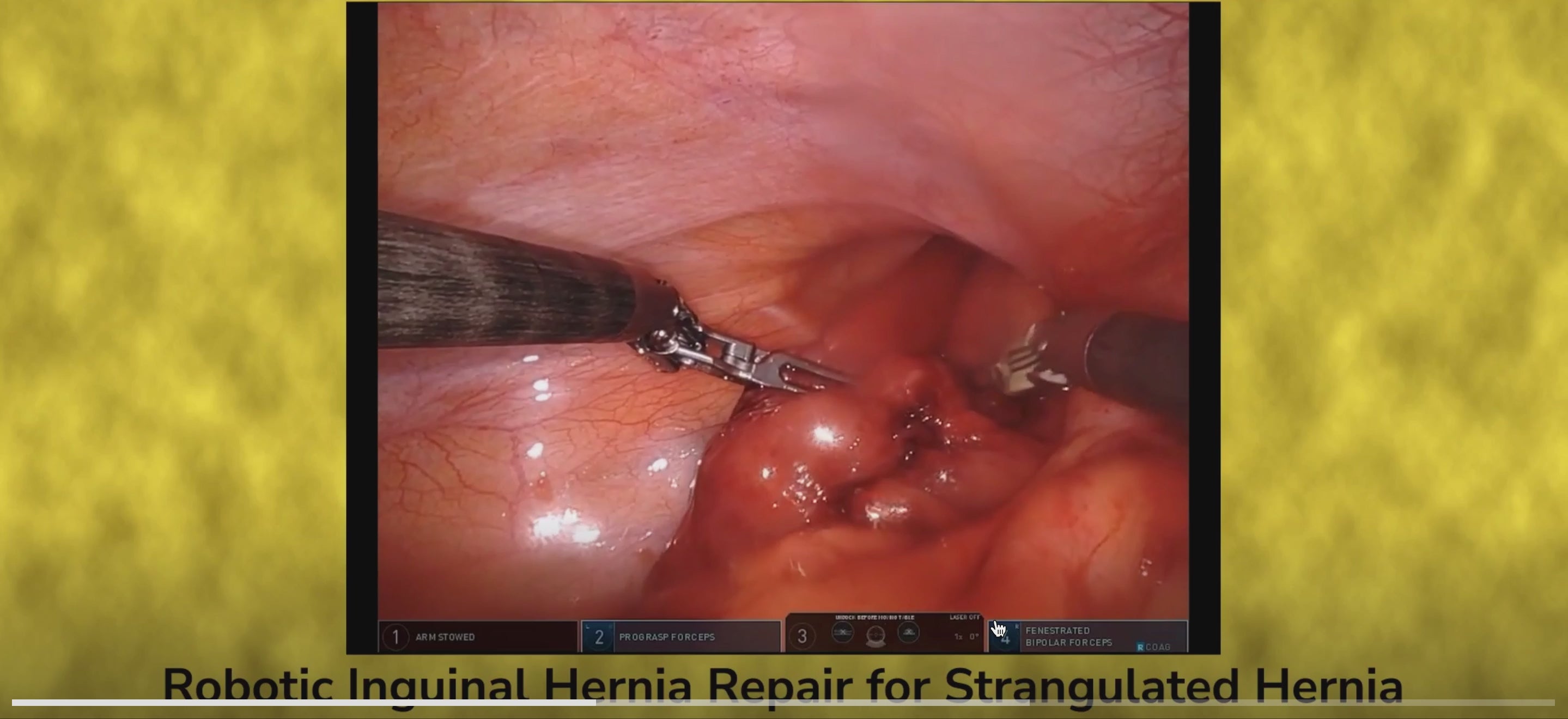 Master the Art of Surgery with Precision and Confidence