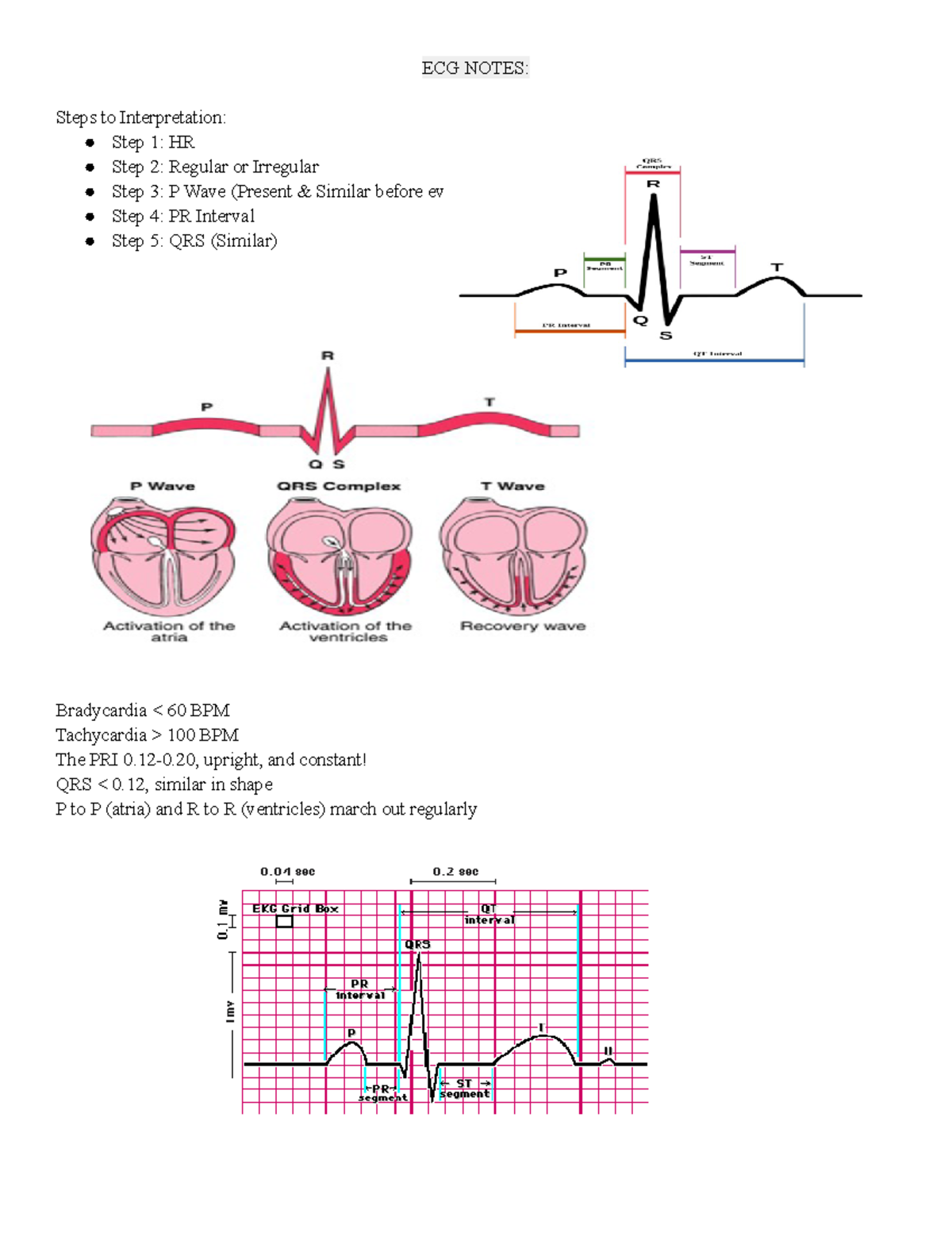 ECG Mastery